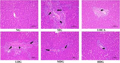 Integrating Network Analysis and Metabolomics to Reveal Mechanism of Huaganjian Decoction in Treatment of Cholestatic Hepatic Injury